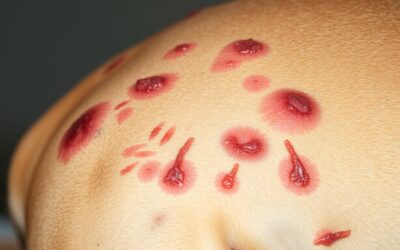 Online magazín CricksyDog 18 Svědění kůže u psa – Vše, co o tom potřebujete vědět!